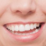 歯の種類の英語一覧